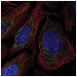 POLDIP2 Antibody, Novus Biologicals:Antibodies:Primary Antibodies