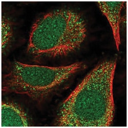 POLE4 Antibody, Novus Biologicals:Antibodies:Primary Antibodies