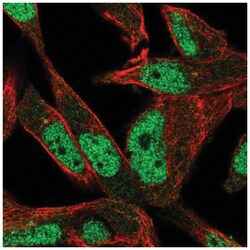 POLN Antibody, Novus Biologicals 25 &mu;L, Unlabeled:Antibodies, Polyclonal
