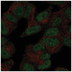 POLR3D Antibody, Novus Biologicals 100&mu;L; Unlabeled:Antibodies, Polyclonal