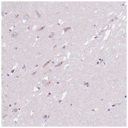 POMC Antibody, Novus Biologicals 100&mu;L; Unlabeled:Antibodies, Polyclonal