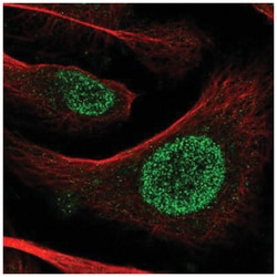 POT1 Antibody, Novus Biologicals:Antibodies:Primary Antibodies