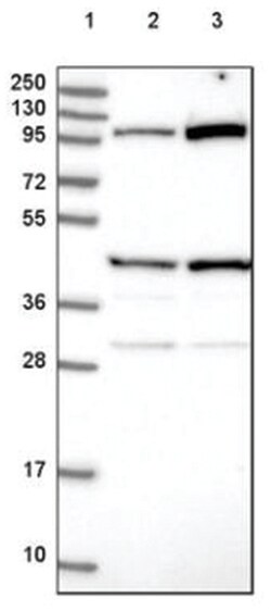 POTEE Antibody, Novus Biologicals 100&mu;L; Unlabeled:Antibodies, Polyclonal