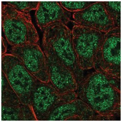 POU5F1P1 Antibody, Novus Biologicals 100&mu;L; Unlabeled:Antibodies, Polyclonal