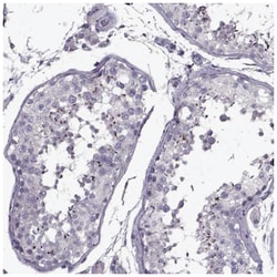 PP2D1 Antibody, Novus Biologicals 100&mu;L; Unlabeled:Antibodies, Polyclonal