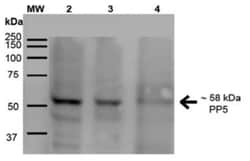 PP5 Antibody (2E11), Novus Biologicals:Antibodies:Primary Antibodies
