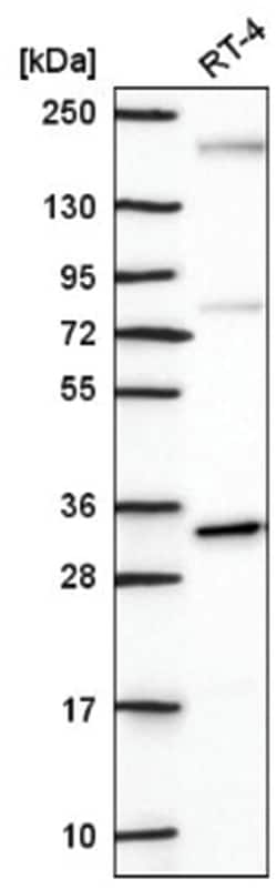 PPAP2B Antibody, Novus Biologicals:Antibodies:Primary Antibodies