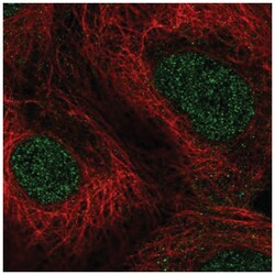 PPAR alpha/NR1C1 Antibody, Novus Biologicals:Antibodies:Primary Antibodies