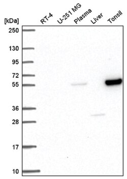 PPAR alpha/NR1C1 Antibody, Novus Biologicals:Antibodies:Primary Antibodies