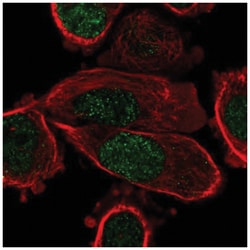 PPAR gamma/NR1C3 Antibody, Novus Biologicals 25 &mu;L:Antibodies, Polyclonal