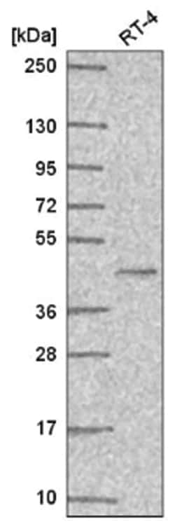 PPAR gamma/NR1C3 Antibody, Novus Biologicals:Antibodies:Primary Antibodies