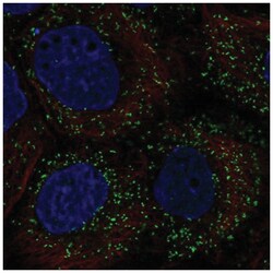 PPP1R11 Antibody, Novus Biologicals 100&mu;L; Unlabeled:Antibodies, Polyclonal