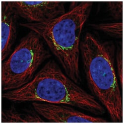 PPP1R15B Antibody, Novus Biologicals 25 &mu;L, Unlabeled:Antibodies, Polyclonal