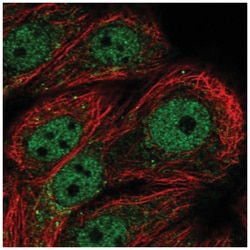 PPP1R3F Antibody, Novus Biologicals 25 &mu;L:Antibodies, Polyclonal