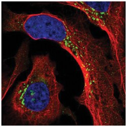 PPP2R3A Antibody, Novus Biologicals 100&mu;L; Unlabeled:Antibodies, Polyclonal