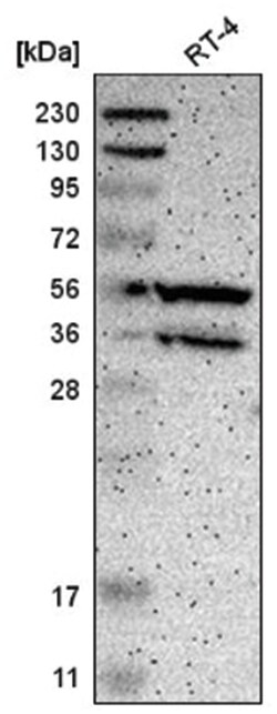 PPP3CB Antibody, Novus Biologicals 100&mu;L; Unlabeled:Antibodies, Polyclonal