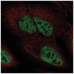 PPP4R2 Antibody, Novus Biologicals:Antibodies:Primary Antibodies
