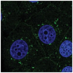 Presenilin-1 Antibody, Novus Biologicals:Antibodies:Primary Antibodies