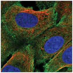 PRIMA1 Antibody, Novus Biologicals 100&mu;L; Unlabeled:Antibodies, Polyclonal