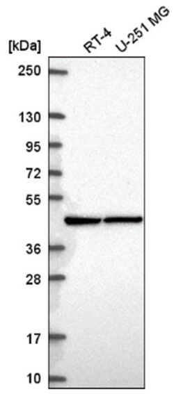 PRMT1 Antibody, Novus Biologicals 100&mu;L; Unlabeled:Antibodies, Polyclonal