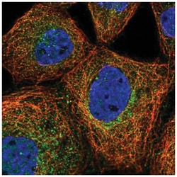 PRMT10 Antibody, Novus Biologicals 100&mu;L; Unlabeled:Antibodies, Polyclonal