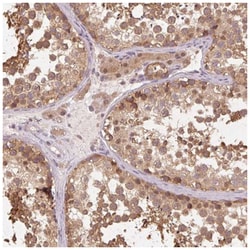 PRMT5 Antibody, Novus Biologicals 25 &mu;L; Unconjugated:Antibodies, Polyclonal