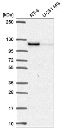 Protein Kinase D2 Antibody, Novus Biologicals 25 &mu;L, Unlabeled:Antibodies,
