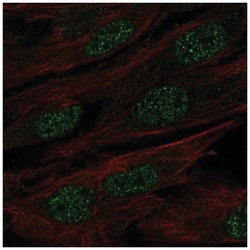 Protein mab-21-like 1 Antibody, Novus Biologicals:Antibodies:Primary Antibodies