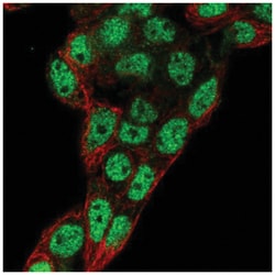 Prox1 Antibody, Novus Biologicals 25 &mu;L:Antibodies, Polyclonal