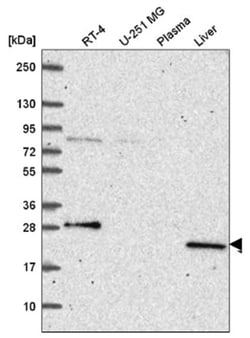 PRPS2 Antibody, Novus Biologicals 25 &mu;L, Unlabeled:Antibodies, Polyclonal