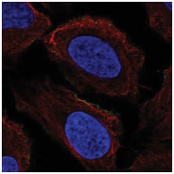 PRRT2 Antibody, Novus Biologicals 100&mu;L; Unlabeled:Antibodies, Polyclonal