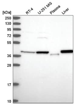 PSAT1 Antibody, Novus Biologicals:Antibodies:Primary Antibodies