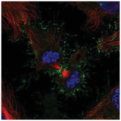 PSCA Antibody, Novus Biologicals:Antibodies:Primary Antibodies