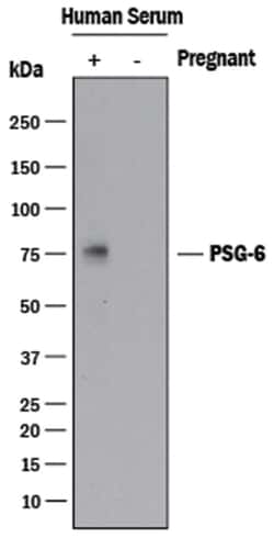 Human PSG6 Antibody, R D Systems:Antibodies:Primary Antibodies