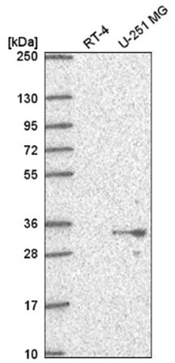 PSMG1 Antibody, Novus Biologicals 100&mu;L; Unlabeled:Antibodies, Polyclonal