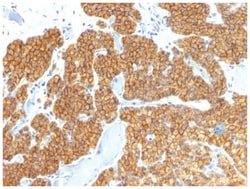 PTH Mouse anti-Human, Clone-PTH/911, Novus Biologicals 100&mu;g; Unlabeled:Antibodies,
