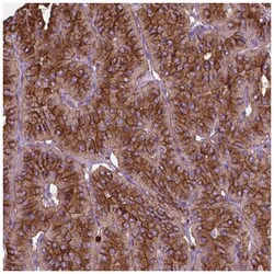 PTH Antibody, Novus Biologicals:Antibodies:Primary Antibodies