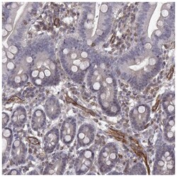 PTP gamma/PTPRG Antibody, Novus Biologicals 25 &mu;L, Unlabeled:Antibodies,