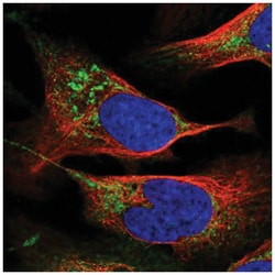 PTPMT1 Antibody, Novus Biologicals 25 &mu;L:Antibodies, Polyclonal