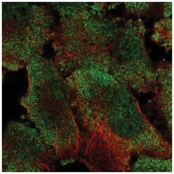 PUM1 Antibody, Novus Biologicals 25 &mu;L, Unlabeled:Antibodies, Polyclonal