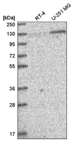 PUM2 Antibody, Novus Biologicals 100&mu;L; Unlabeled:Antibodies, Polyclonal