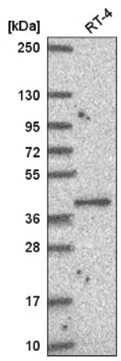 PUS1 Antibody, Novus Biologicals 25 &mu;L, Unlabeled:Antibodies, Polyclonal