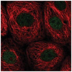 PWWP2B Antibody, Novus Biologicals 25 &mu;L, Unlabeled:Antibodies, Polyclonal