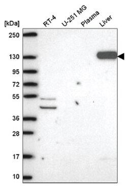 Pyruvate Carboxylase Antibody, Novus Biologicals:Antibodies:Primary Antibodies