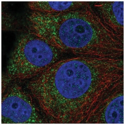 QTRT1 Antibody, Novus Biologicals:Antibodies:Primary Antibodies