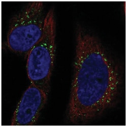 RAB30 Antibody, Novus Biologicals:Antibodies:Primary Antibodies