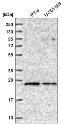Rab5a Antibody, Novus Biologicals 100&mu;L; Unlabeled:Antibodies, Polyclonal