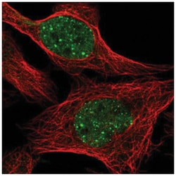 RAD18 Antibody, Novus Biologicals:Antibodies:Primary Antibodies