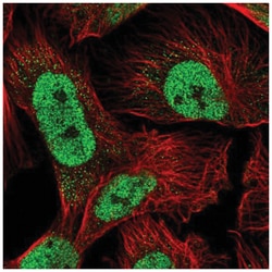 HR23A/Rad23A TUBE1 Antibody, Novus Biologicals 100&mu;L; Unlabeled:Antibodies,