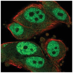 Rad23 Antibody, Novus Biologicals:Antibodies:Primary Antibodies